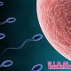 Qual é o Método Anticoncepcional Mais Eficiente? Qual é o Método Anticoncepcional Mais Eficiente?
